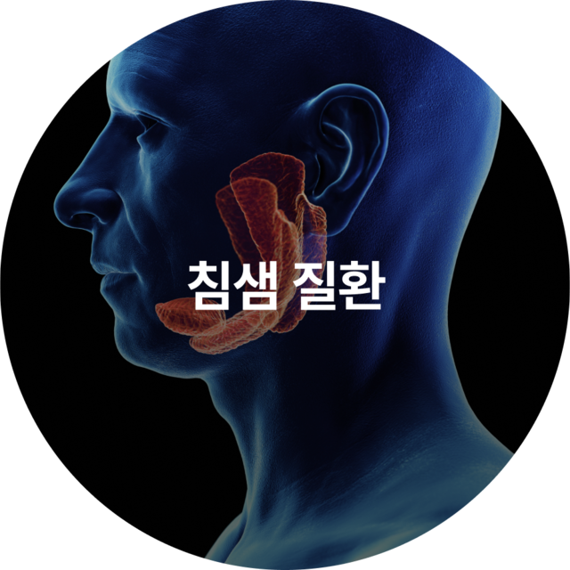 침샘 질환