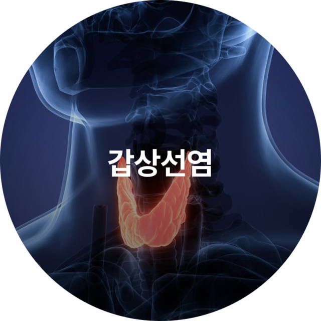 갑상선염
