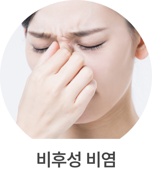 비알레르기 비염